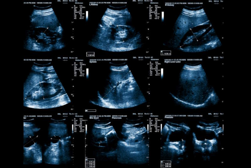 ecografia cardiaca a roma eur cmc